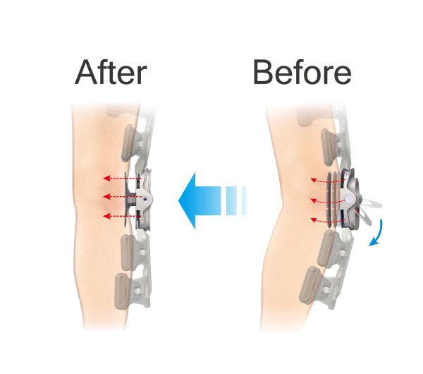 PUSH-POWER OA KNEE BRACE (STANDARD)