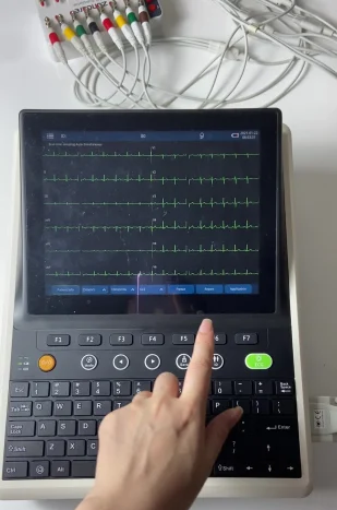 Classic 12 Channel ECG Machine