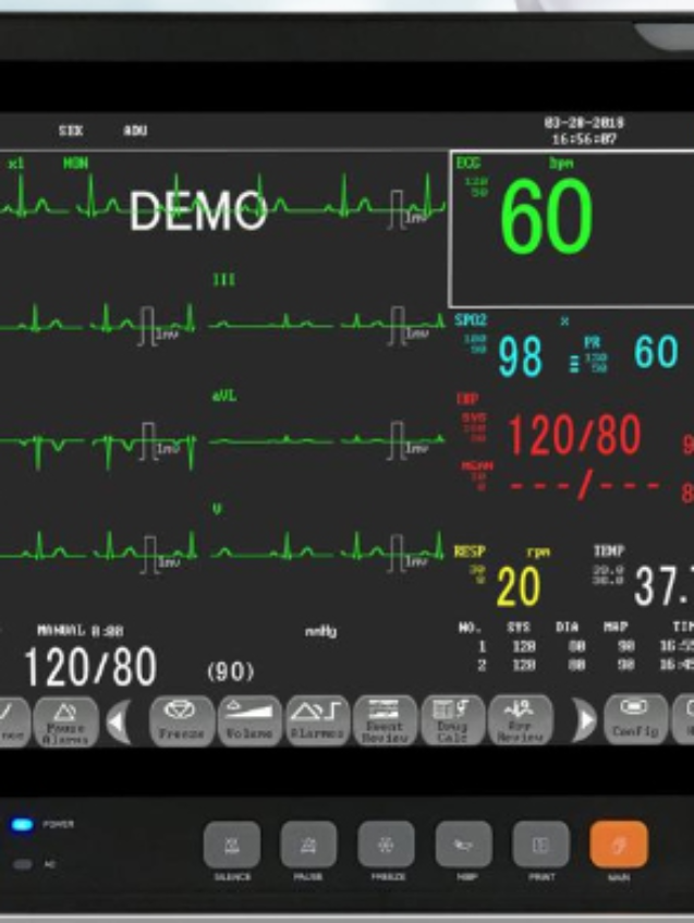 Multi Parameter Patient Monitor